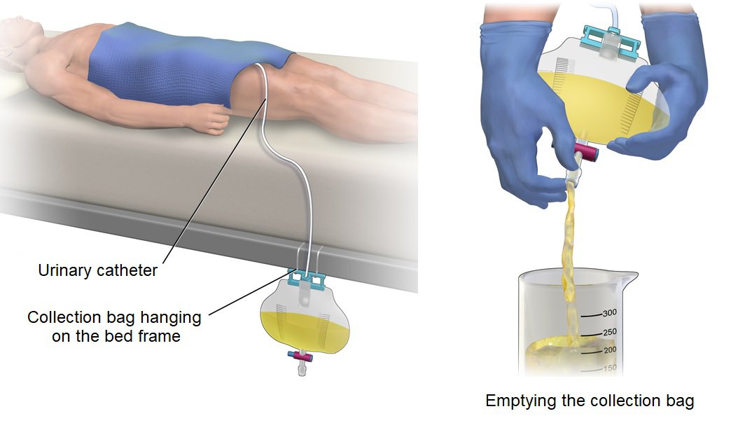 Traces of blood in urine pregnant