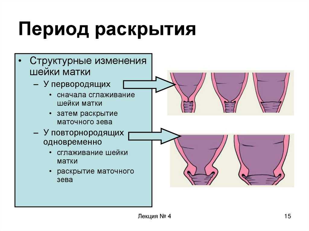 Cervix contractions during pregnancy