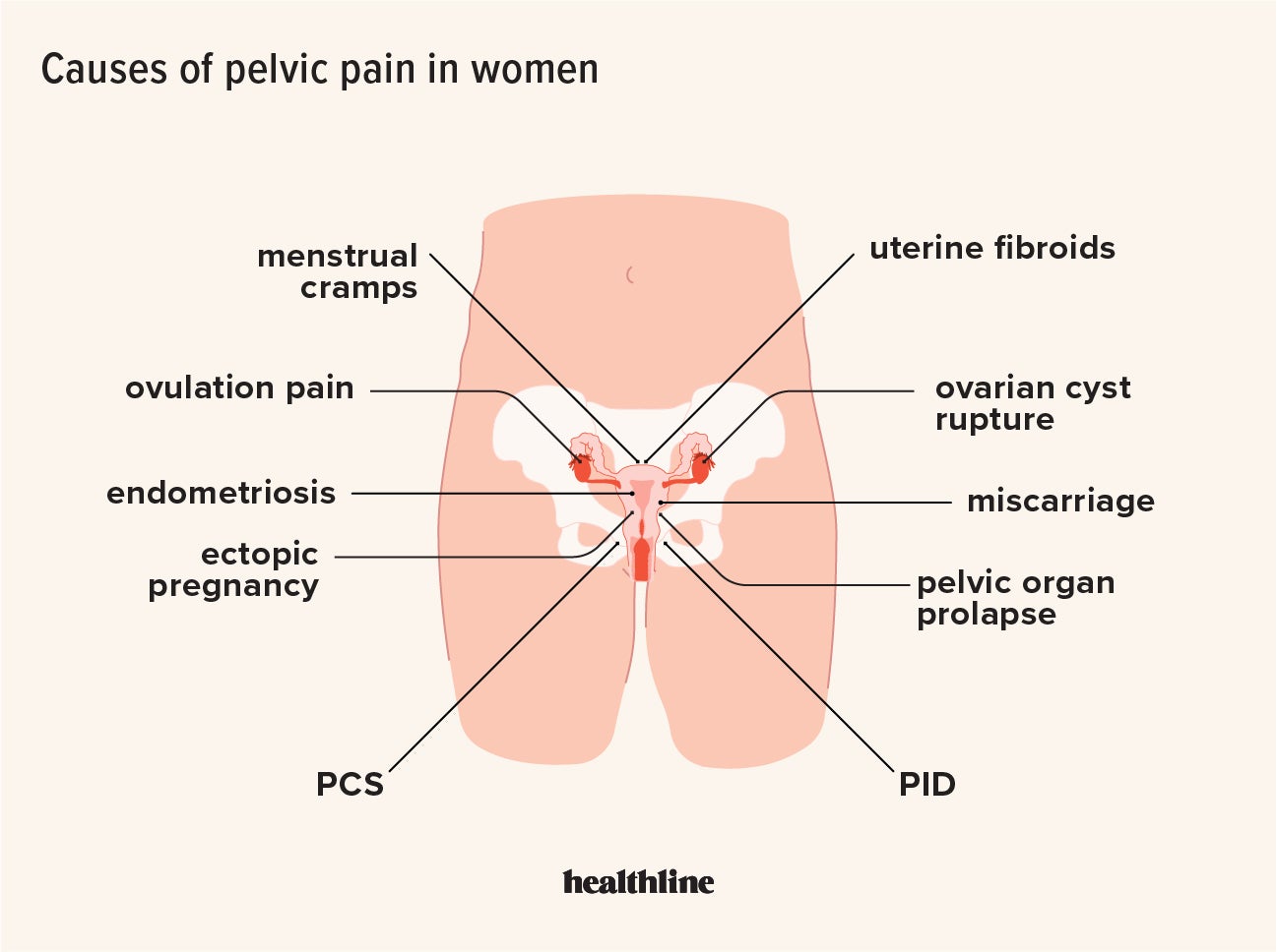 Can constipation cause pelvic pain during pregnancy